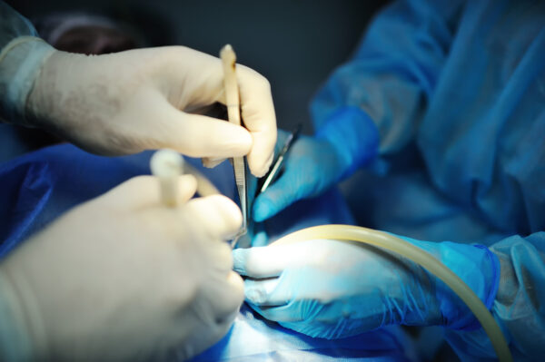 Close-up of two surgeons' gloved hands and instruments as they perform surgery on a patient.